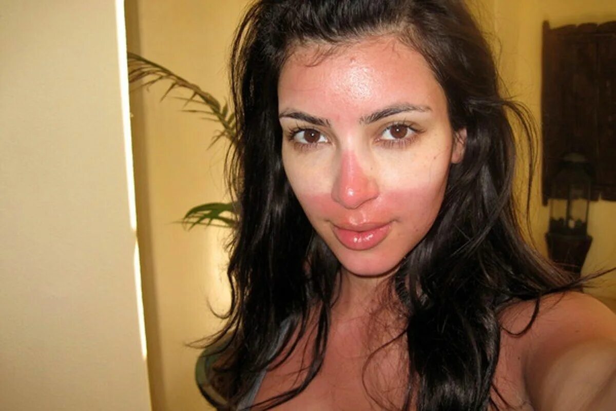 Ожог лица от солнца фото Here’s How to Treat a Bad Sunburn, Fast