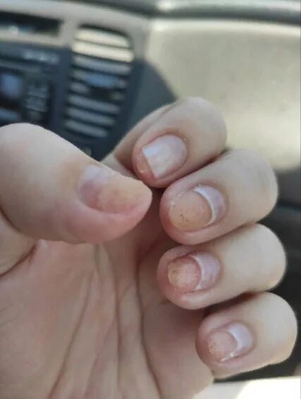 Ожог ногтя при маникюре фото The Master's Manicure Kopylyovy Tatyana, who took my fingernails on the rocks an