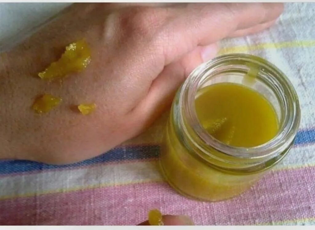 Ожог от крема фото Folk recipe from face, skin diseases, wounds Here is what N. I. Shchavelev, Ivan