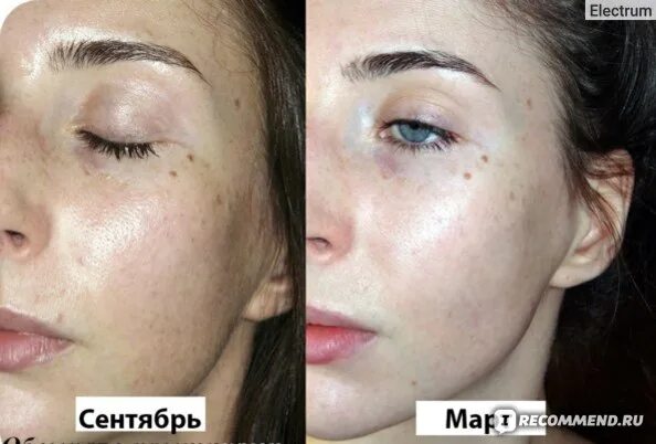 Ожог от крема фото Крем для лица Reviva Labs 5% Glycolic Acid Cream - "Первый опыт применения кисло