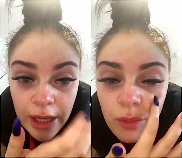 Ожог после наращивания ресниц фото A woman temporarily went blind after a salon used nail glue to apply her lash ex