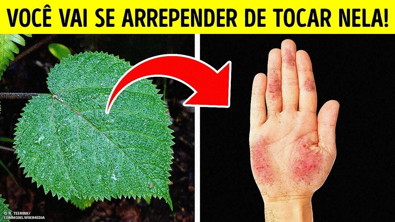 Ожог растением как выглядит Uma Planta Impiedosa Que Faz Seu Corpo Doer por Anos a Fio - YouTube