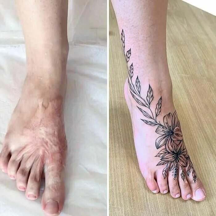 Ожог тату фото Tattoo Artists Who Turned Scars and Birthmarks Into Works of Art Buzzerilla Tatt