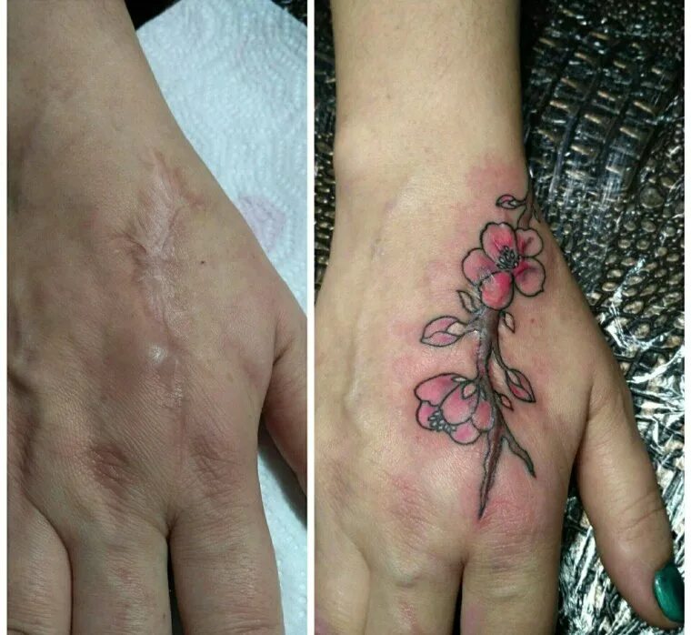 Ожог тату фото Tattoos that perfectly hide scars - Gorodprizrak