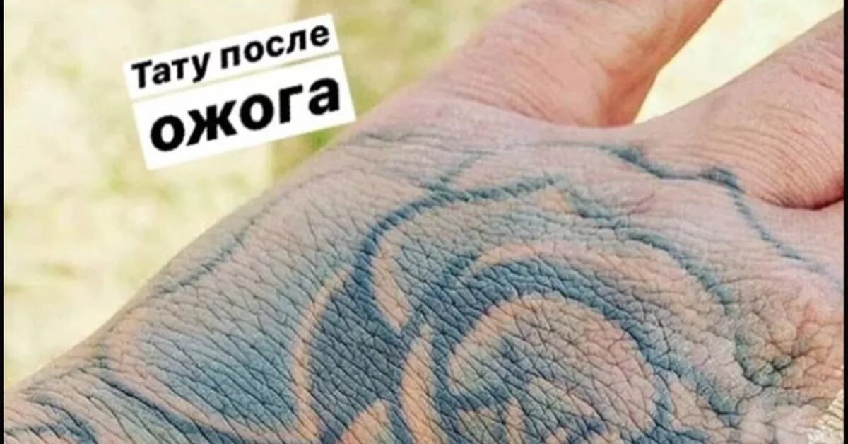 Ожог тату фото Татуировка Пикабу