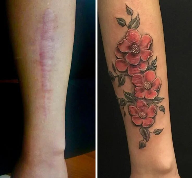 Ожог тату фото Pin by DKPH on Tats Tattoos to cover scars, Cover tattoo, Scars tattoo cover up