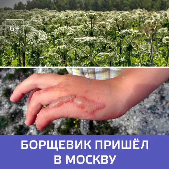 Ожог травой фото Юлия Бодрикова - Заметки OK.RU