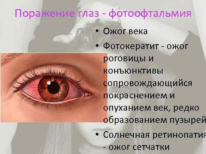 Ожог века фото Передозировка ультрафиолетом Ультрафиолет Часть спектра солнечного
