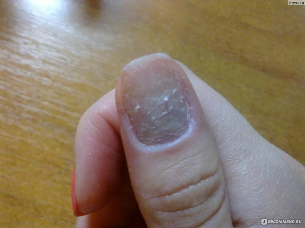 Ожоги маникюра фото Гель-лак для ногтей CND Shellac / Шилак / Шеллак - "мой шок после снятия Shellac