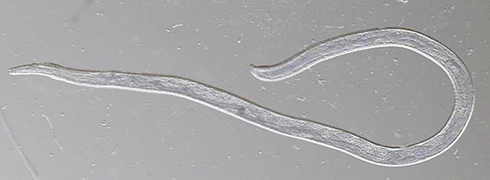Паразиты в глазу фото A Woman From Oregon Is The First Person Ever Infected With This Gross Cattle Par