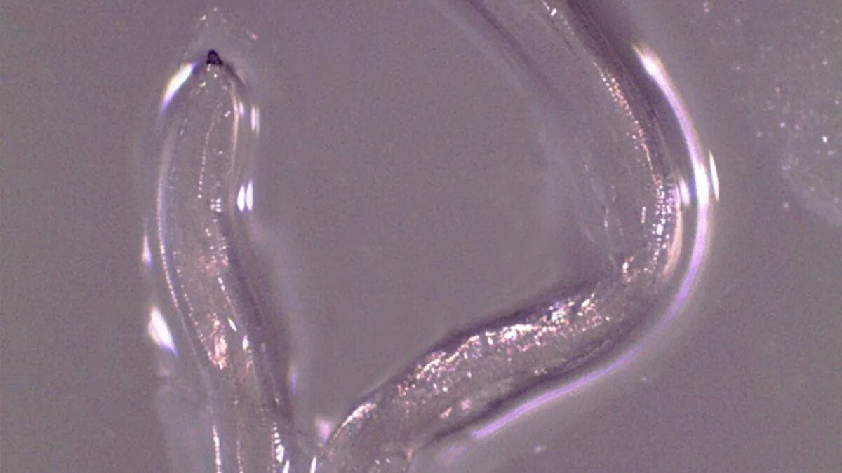 Паразиты в глазу фото First Human Case of Eye Worm Thelazia Gulosa Found in Oregon Woman