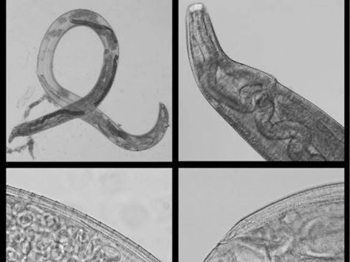 Паразиты в глазу фото Parasitic worms found in woman’s eye as scientists warn of 'emerging' disease Th