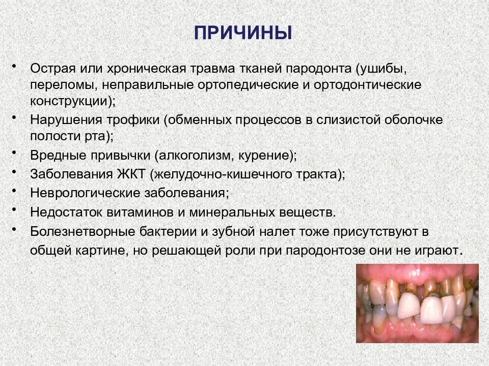 Пародонтит симптомы фото и лечение Местные факторы заболеваний пародонта