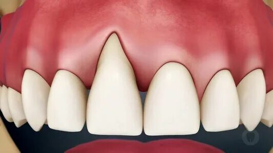 Пародонтоз симптомы фото Panorama: Dental Home, dental clinic, Ufa, ulitsa Sofyi Perovskoy, 36 - Yandex M