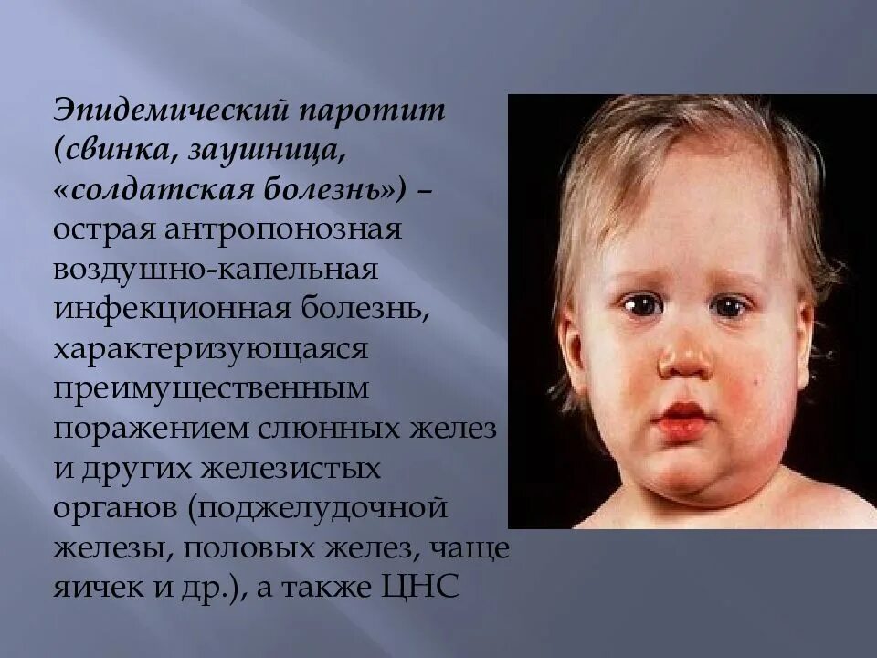 Паротит симптомы у детей фото Против эпидемического паротита