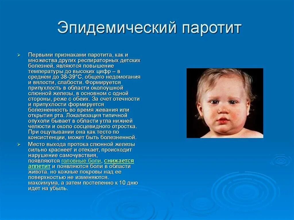 Паротит симптомы у детей фото Симптомы паротита (свинки) у детей на разных стадиях, методы лечения и профилакт