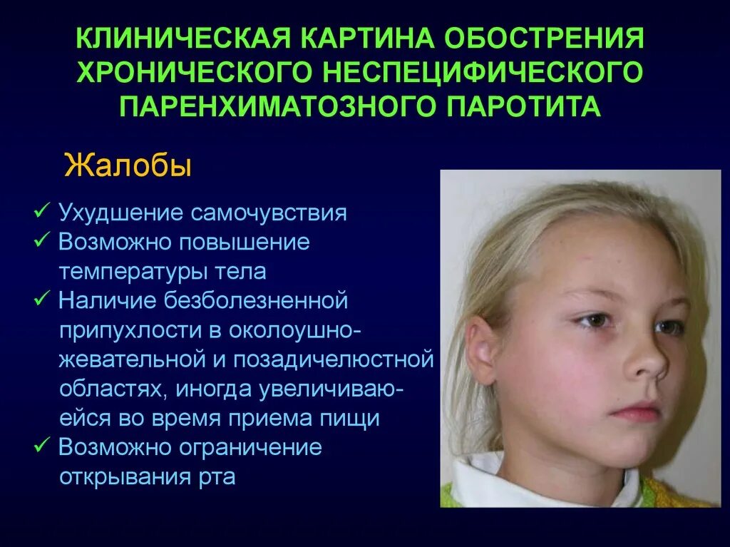 Паротит симптомы у детей фото Вирусный паротит у детей симптомы - фото презентация