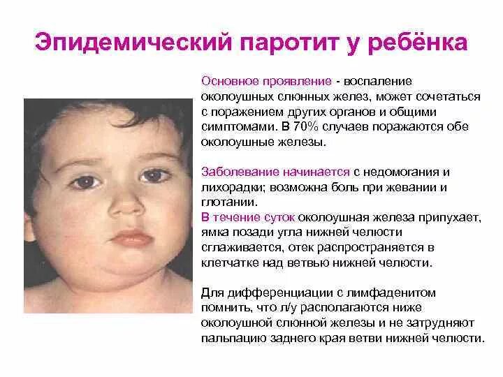 Паротит сыпь фото Признаки свинки фото: найдено 30 изображений