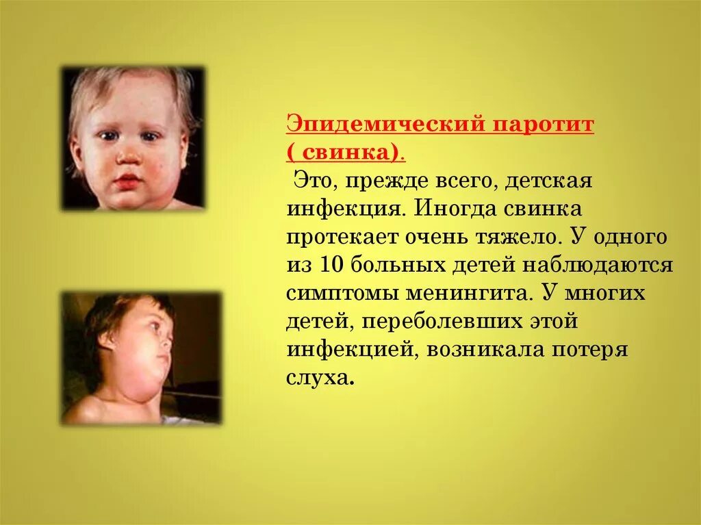 Паротит у детей симптомы и лечение фото Эпидемический паротит: 4 основных симптома, 7 осложнений