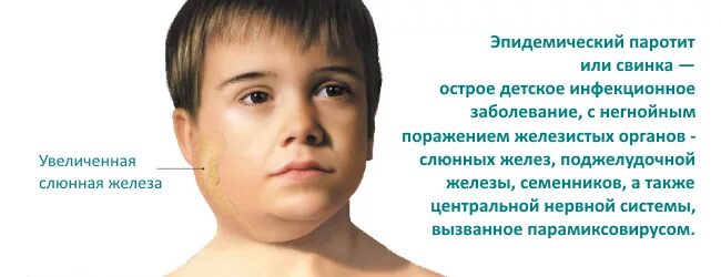 Паротит у детей симптомы и лечение фото Ответы Mail.ru: признаки свинки