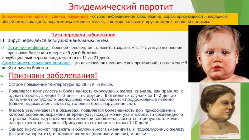 Паротит у детей симптомы и лечение фото Эпидемический паротит: 4 основных симптома, 7 осложнений