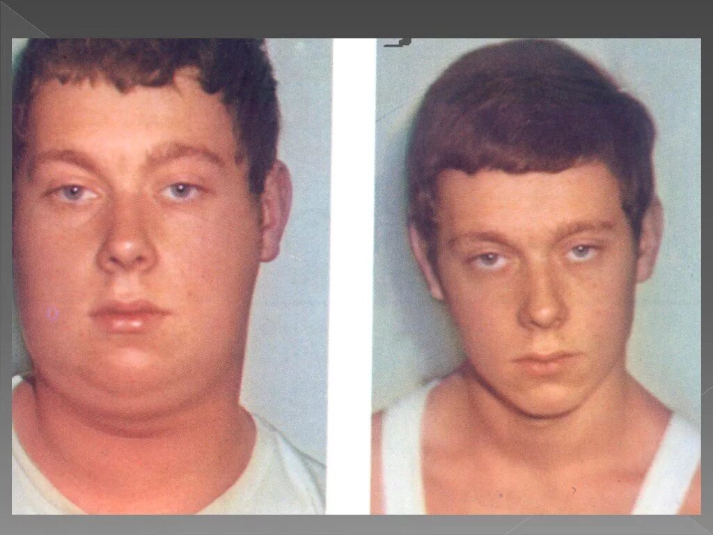 Паротит у взрослых симптомы и лечение фото Болезнь свинка: фото, последствия и способы лечения - Фото болезней