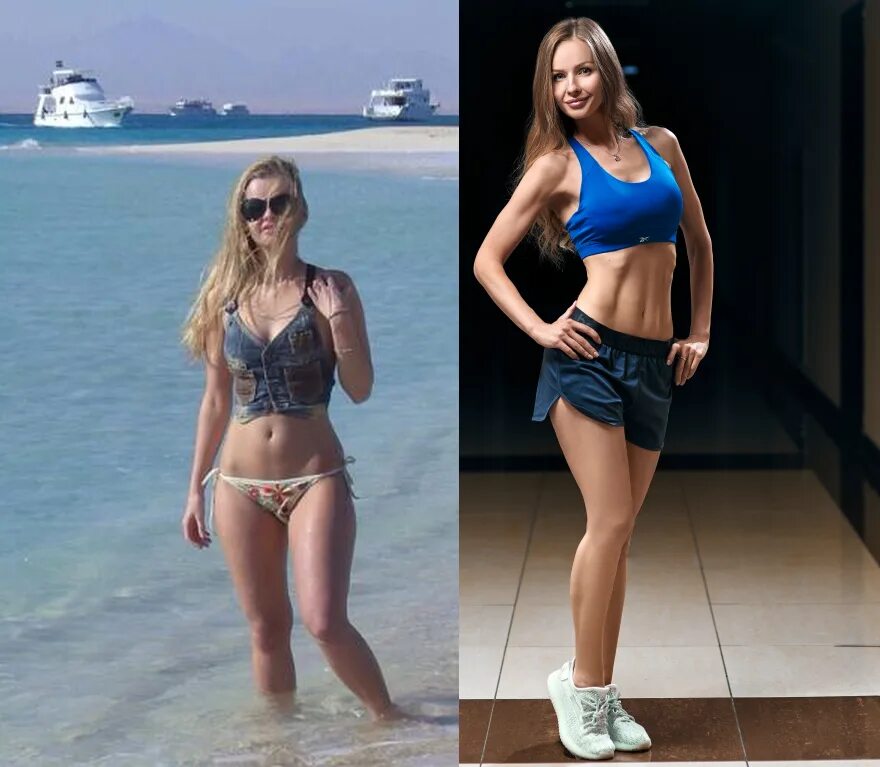 Паршута до и после пластики фото Паршута до и после пластики