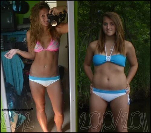Паршута до и после пластики фото ДО и ПОСЛЕ мотивация - Фотография 28 из 80 ВКонтакте