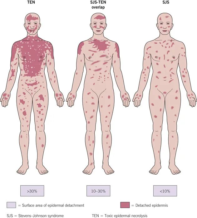 Парвовирус фото сыпи на теле Epidermal Injury/Necrosis Plastic Surgery Key