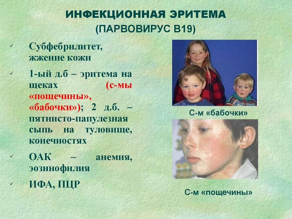Парвовирусная инфекция симптомы фото Дифференциальный диагноз заболеваний, сопровождающихся синдромом экзантемы - пре