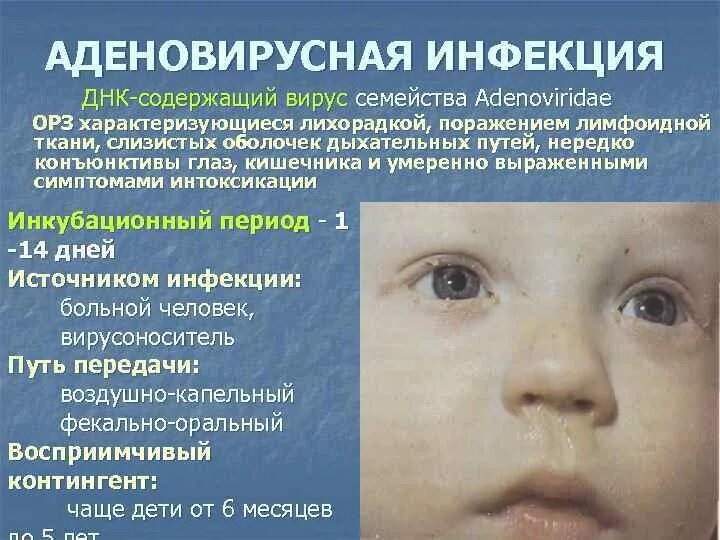 Парвовирусная инфекция сыпь фото ОСТРЫЕ РЕСПИРАТОРНЫЕ ВИРУСНЫЕ ИНФЕКЦИИ Профессор Куприна Надежда Петровна
