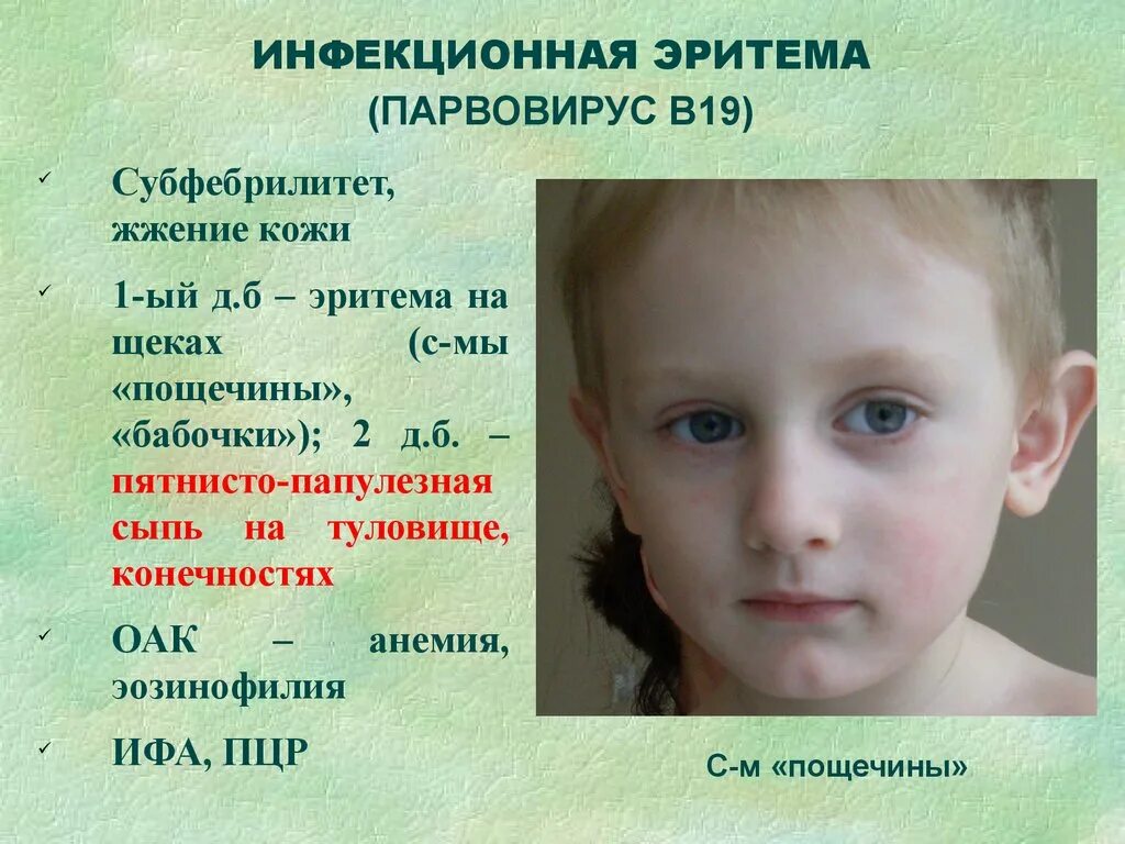 Парвовирусная инфекция у детей симптомы фото Парвовирус у детей лечение
