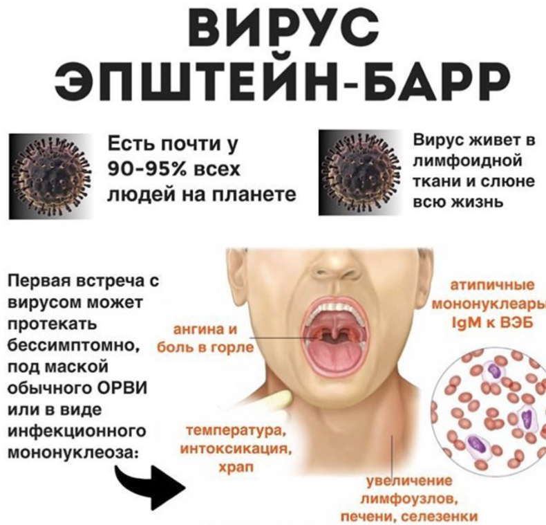Парвовирусная инфекция у детей симптомы фото Вирус Эпштейна–Барра: в чем опасность и как помочь организму