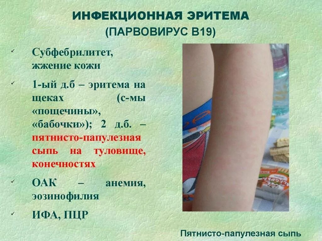 Парвовирусная сыпь фото Парвовирус у детей лечение
