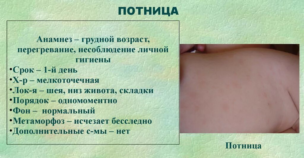 Парвовирусная сыпь у детей фото на коже Потница. Причины, симптомы и лечение