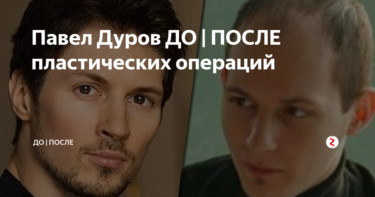 Паша дуров до и после пластики фото Павел Дуров ДО ПОСЛЕ пластических операций До После Дзен