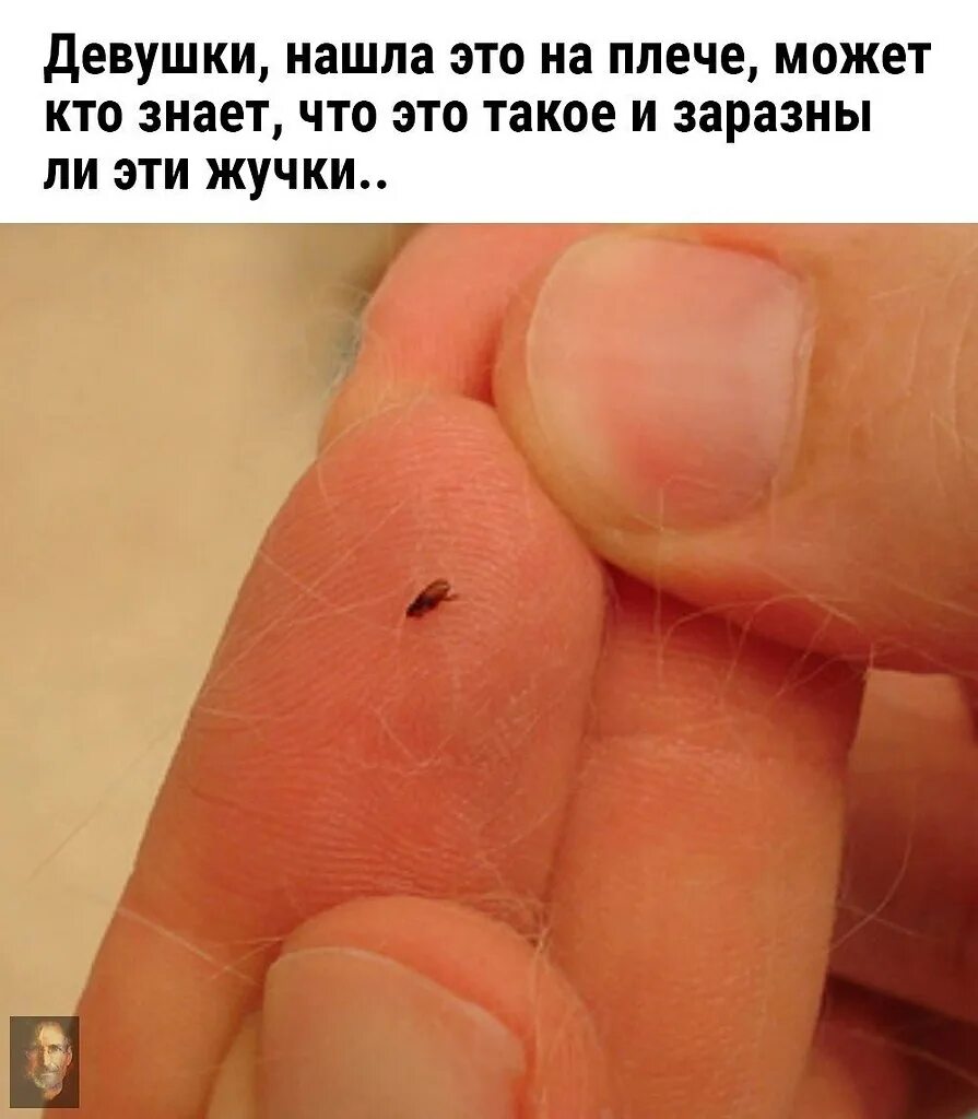 Пастельные блохи фото укусов Положи где взяла! Секреты успеха великих людей