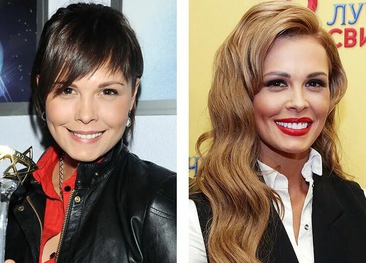 Пацаны звезда до пластики и после фото Мариа Горбань Pretty face, Plastic surgery, Celebrities