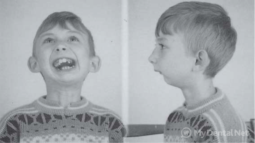 Патологии верхней челюсти у плода фото Deleting a baby tooth. Prices clinics, reviews, forum.