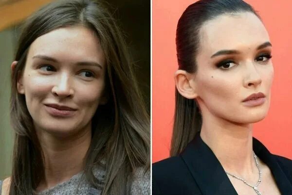 Паулина андреева фото до пластики и после Звезды тоже не идеальны, хороший макияж делает свое дело