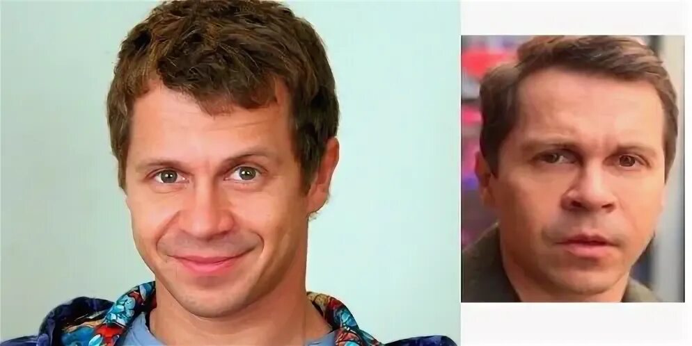 Павел деревянко фото до и после Восемь известных российских мужчин, которые сделали пластику лица (часть 3) Флор
