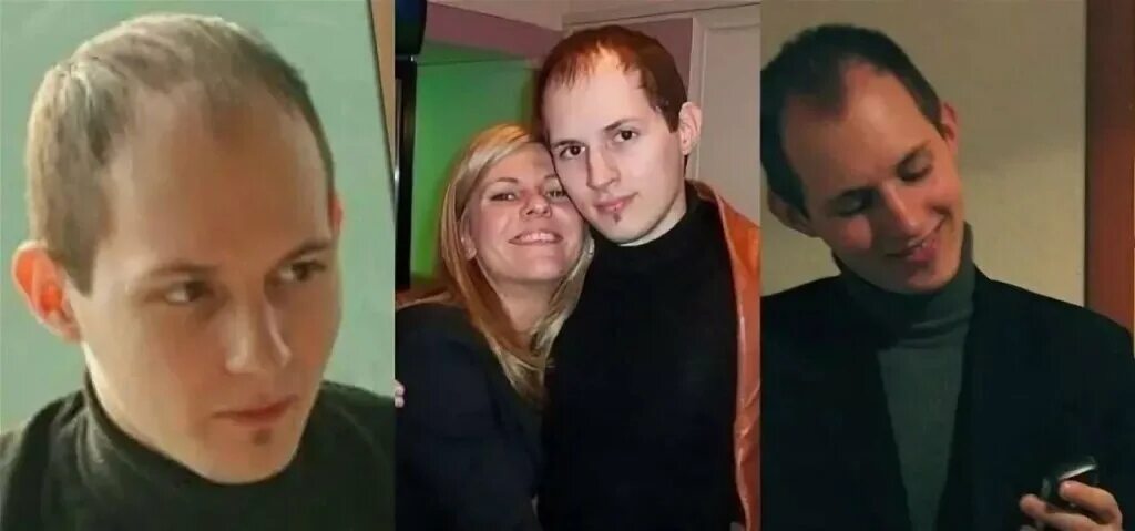 Павел дуров до пластических операций фото А красивые олигархи бывают? Или только такие? В мире искусства и развлечений Дзе