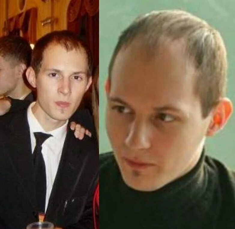 Павел дуров фото до и после Деньги меняют людей? Посмотрите на преображение знаменитых людей до и после Звез