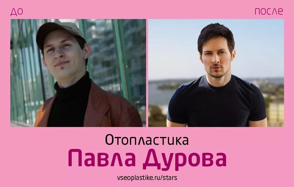 Павел дуров фото до и после Павел Дуров до и после отопластики