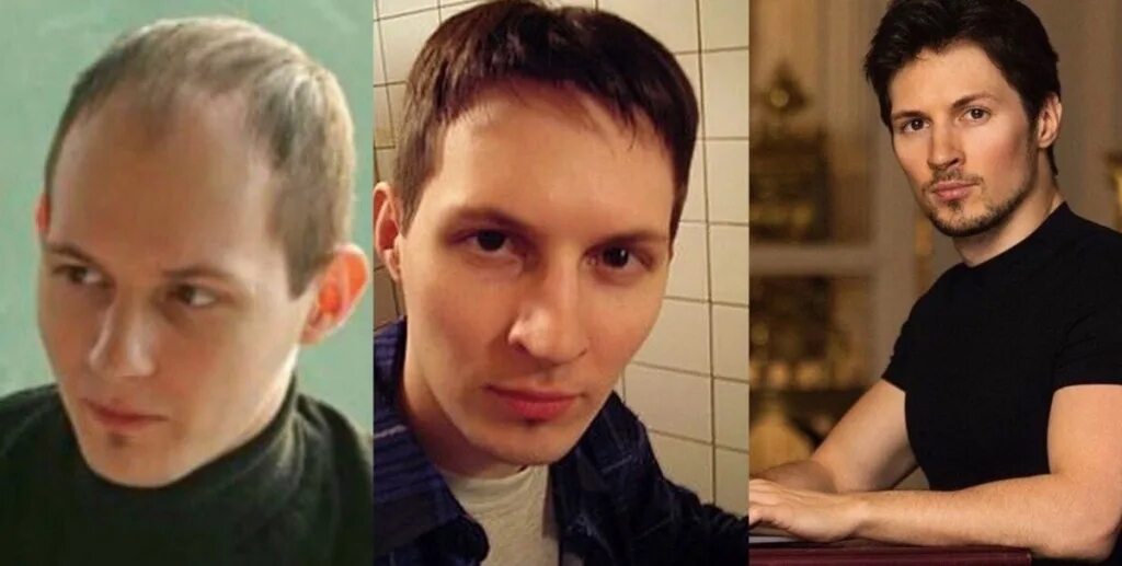 Павел дуров в молодости и сейчас фото Павел Дуров до пластики
