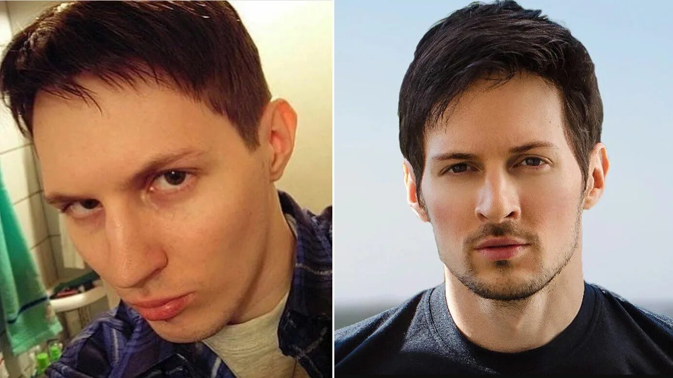 Павел дуров в юности и сейчас фото Пластический хирург Давыдов: Павел Дуров мог сделать отопластику
