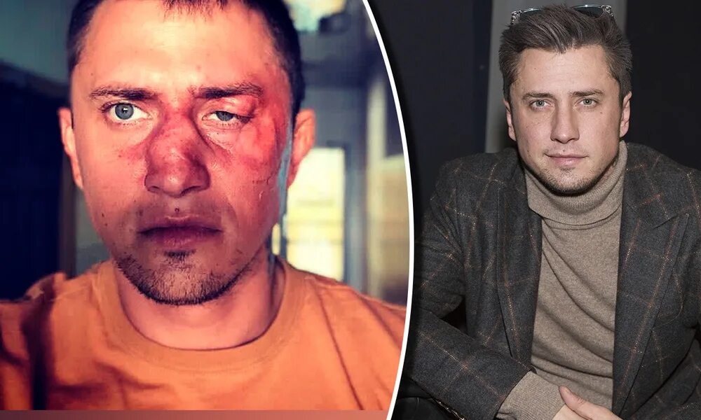 Павел прилучный фото до и после Все версии интереснее правды": Павел Прилучный вышел на связь после слухов об из
