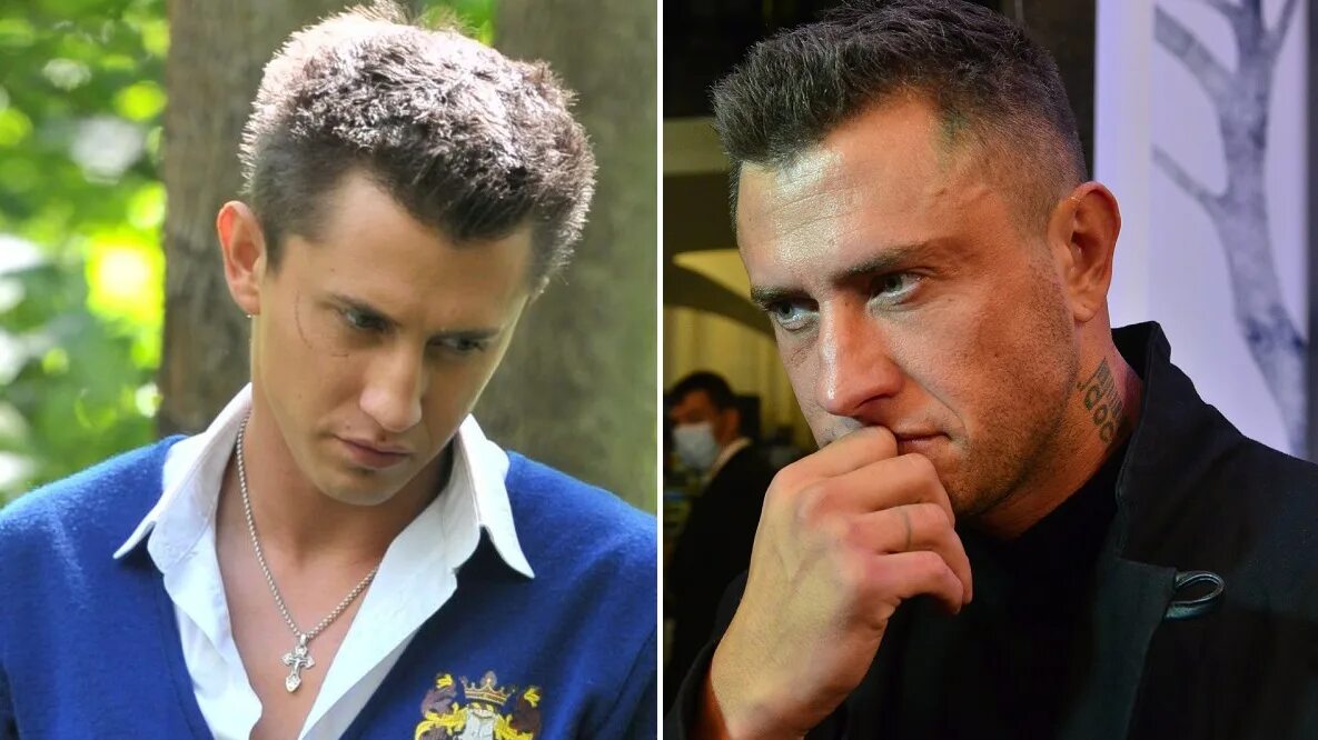 Павел прилучный фото до и после Павел прилучный до и после операции - CollectPhoto.ru