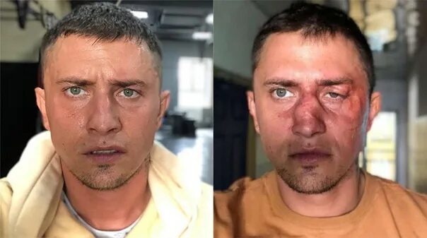 Павел прилучный фото до и после Четыре перелома черепа": Прилучный в суде рассказал о нападении в Калининграде. 