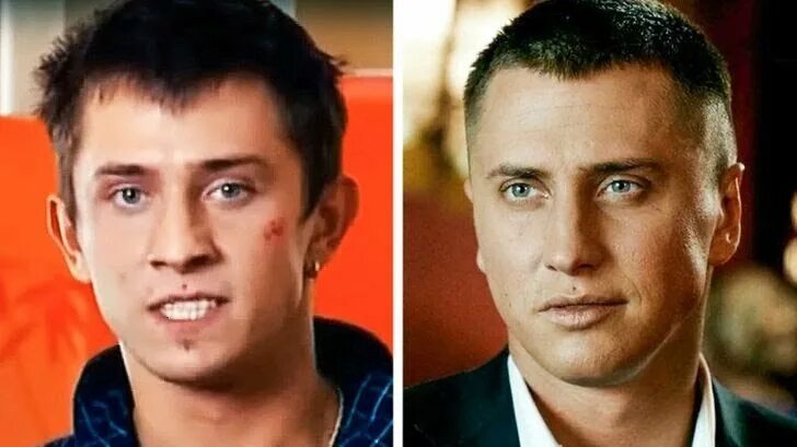 Павел прилучный фото до и после 11 известных мужчин, которые сделали пластику и не побоялись признаться в этом а